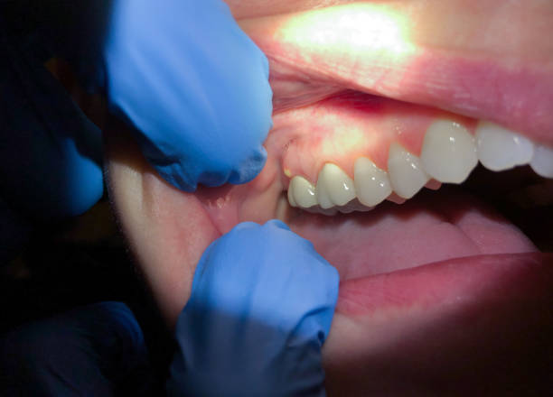 Best Emergency Orthodontic Repairs in Pocola, OK