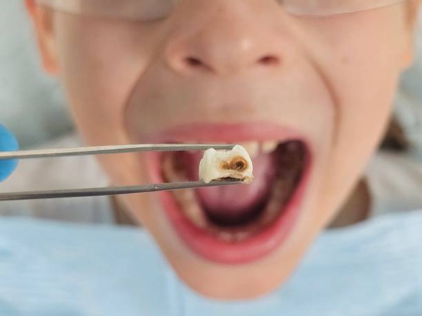 Best Same-Day Emergency Dentist in Pocola, OK
